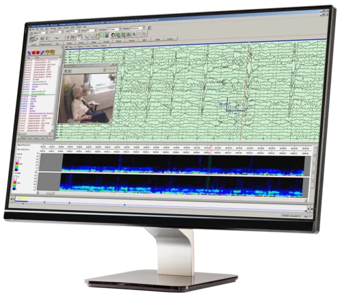 Cybersecurity Vulnerability Discovered in EEG Medical Device NeuroWorks Natus