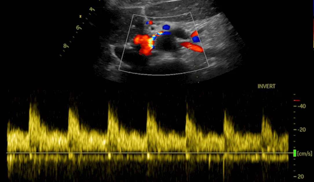 GE HealthCare issues guidance for mitigating 11 security bugs in ultrasound devices