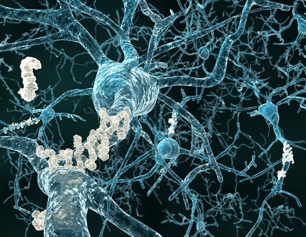 Exosome-encapsulated fluorescent sensors enable advanced brain imaging in Alzheimer’s research