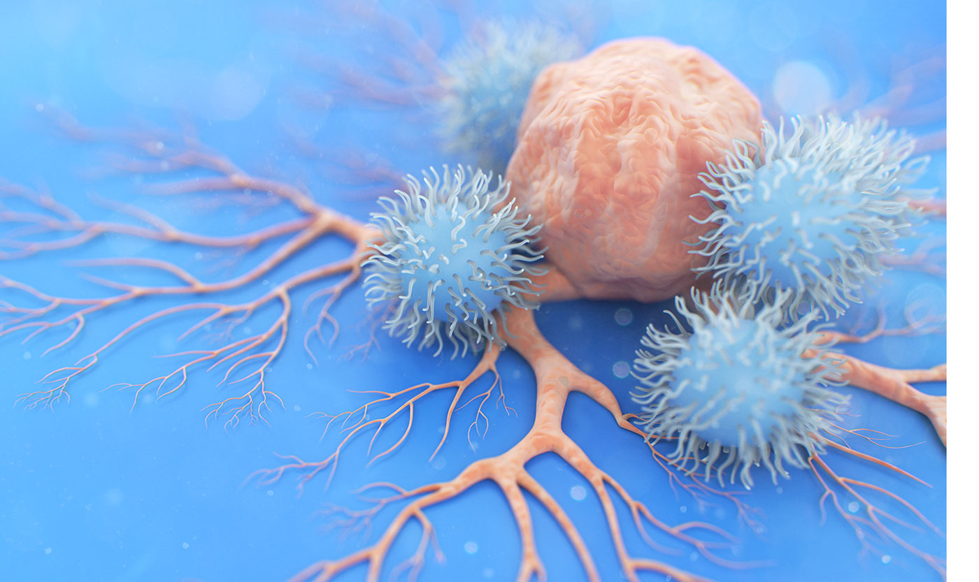 Harnessing the Power of g-NK Cells to Treat Hematologic Malignancies