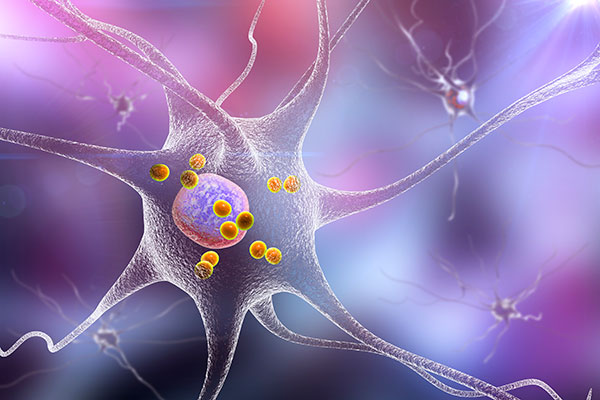Parkinson’s Patients More Likely to Carry Genetic Risk Variants Than Once Thought