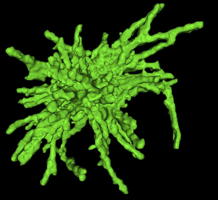 Huntington’s Researchers Discover That Protein Aggregates Poke Holes in the Nuclear Membrane