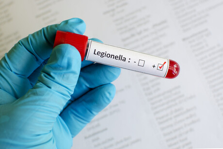 Legionnaires’ disease outbreak in Victoria