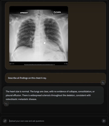 Harrison.ai launches radiology-specific language model